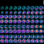 Nuclear Medicine MPS (Myocardial Perfusion Study) Bulk-Billed at North Queensland X-Ray Services (Townsville only) image